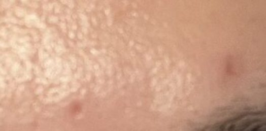 mizubousou ikkagetugo